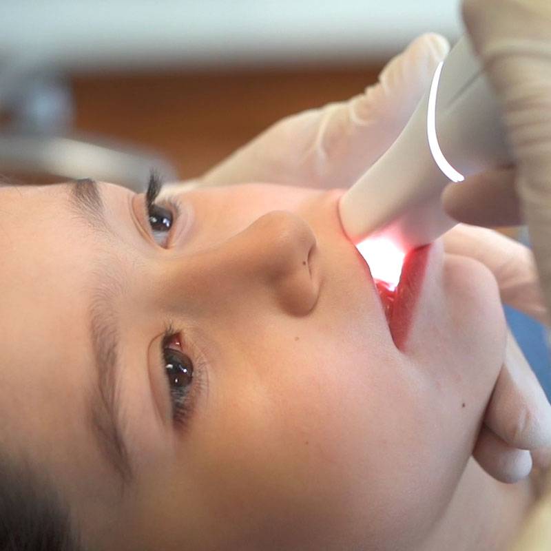 Dentista prima infanzia Jesi Chiaravalle 3Bmedica